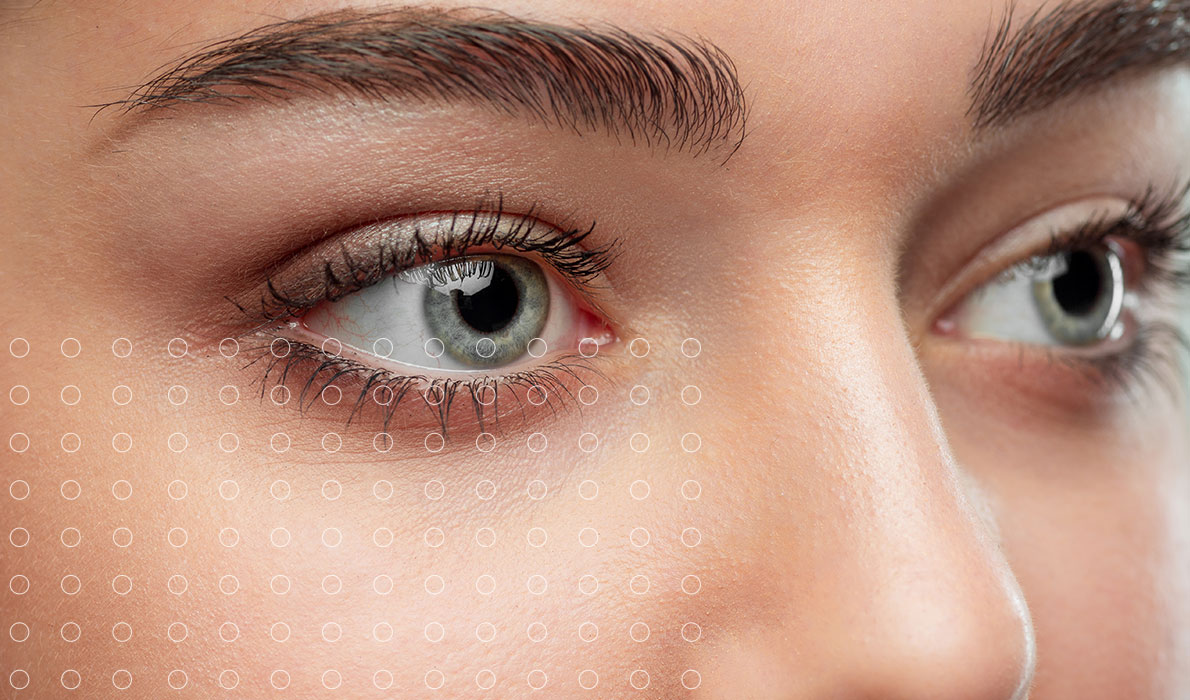 Blefaroplastia láser