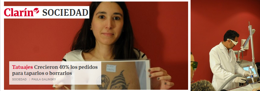 Diario Clarin: nota sobre Borrado de Tatuajes con L�ser